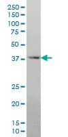 IHC-plus™ DLX2 Antibody (clone 2E12)