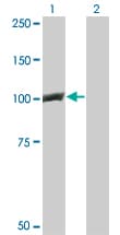 CTNNB1 / Beta Catenin Antibody (clone 1C9)