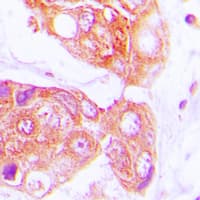 Polyclonal Rabbit anti-Human DNAJB1 / Hsp40 Antibody (C-Terminus, IHC, IF, WB)