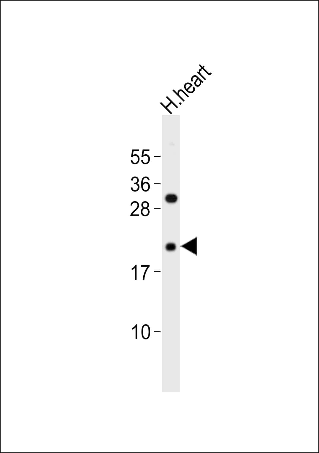 RHOD Antibody