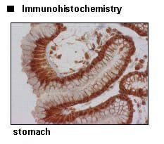 Polyclonal Rabbit anti-Human SLC6A14 Antibody (IHC, WB)