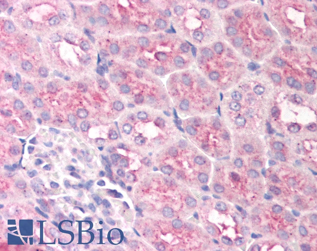 EGLN1 / PHD2 Antibody (Internal, DY650)