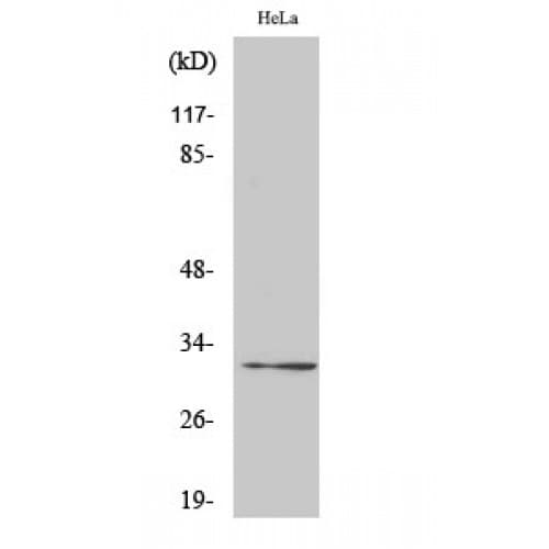 Polyclonal Rabbit anti-Human RPS6 / Ribosomal Protein S6 Antibody (180-260 aa, IHC, IF, WB)