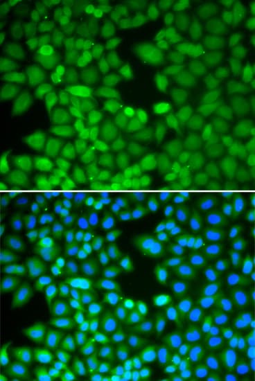 Polyclonal Rabbit anti-Human RAN Antibody (IHC, IF, WB)