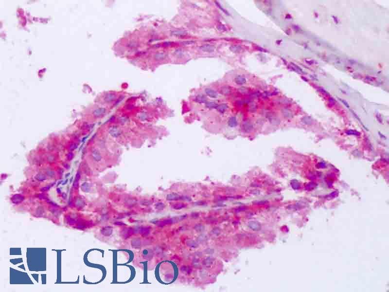 IHC-plus™ Polyclonal Rabbit anti-Human PABPC1 / PABP1 Antibody (aa394-636, IHC, WB)