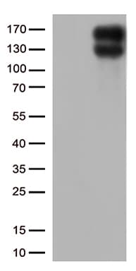 LDLR / LDL Receptor Antibody (clone OTI4E9)