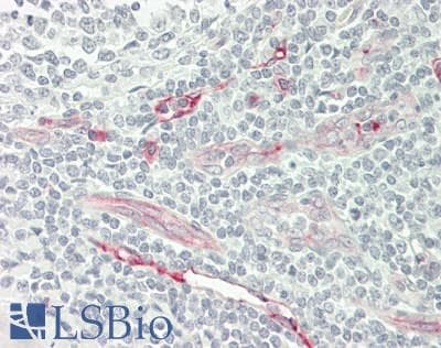 IHC-plus™ Polyclonal Rabbit anti-Human TMPRSS11E Antibody (aa249-277, IHC, WB)