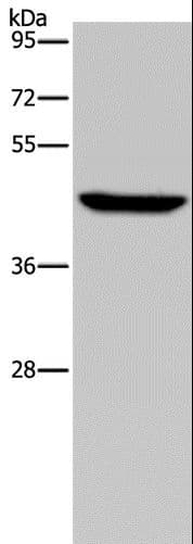 PDSS2 / DLP1 Antibody