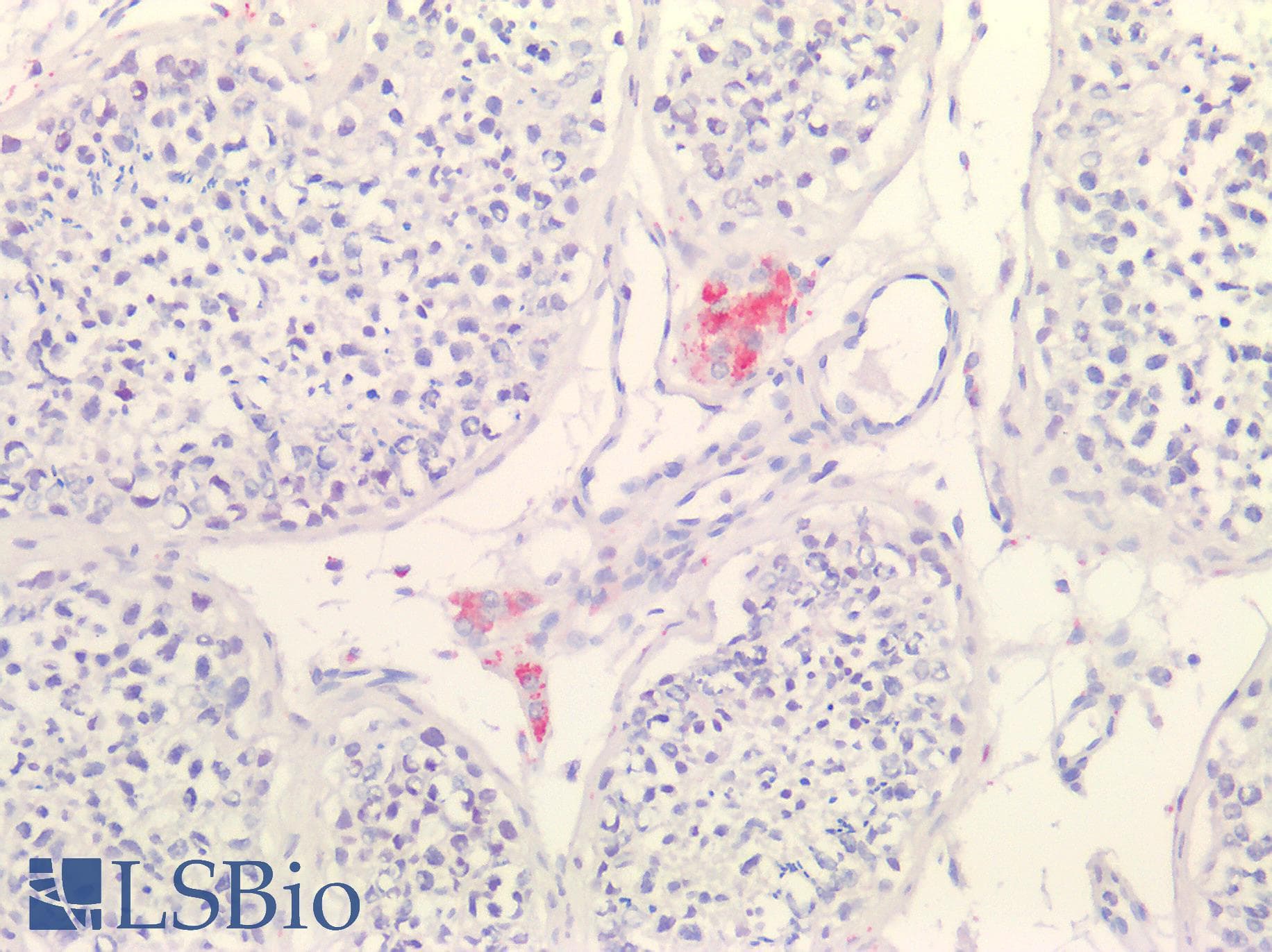 IHC-plus™ Polyclonal Rabbit anti-Human EPDR / EPDR1 Antibody (IHC, WB)