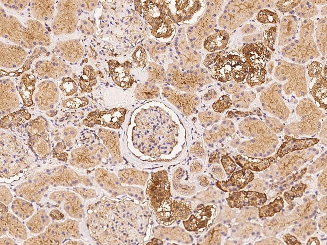 NAV1 Antibody