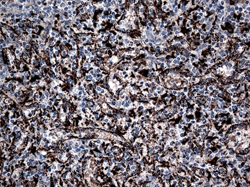 CTSL / Cathepsin L Antibody (aa114-333, clone OTI2C10)