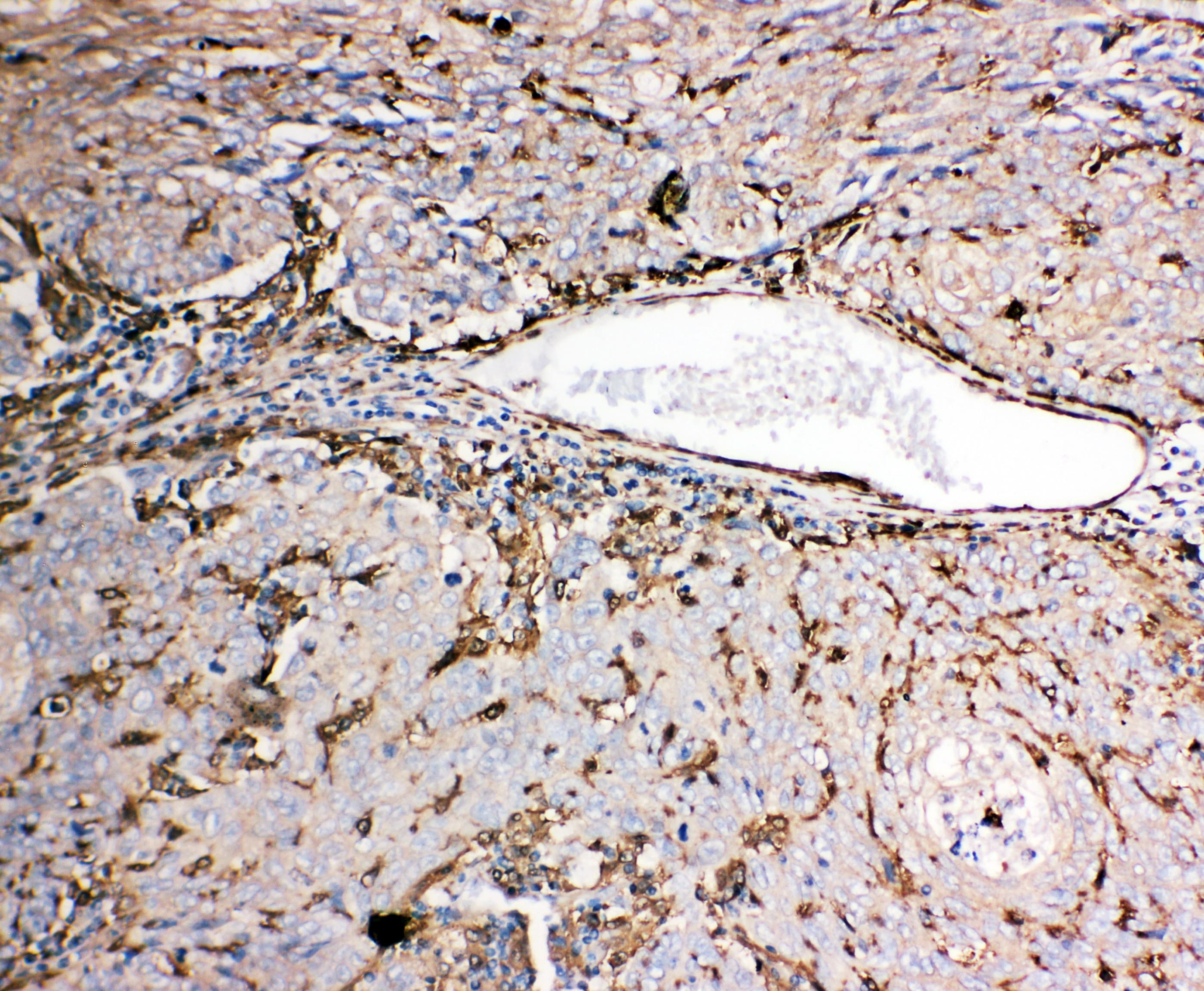 GSN / Gelsolin Antibody (aa763-775)