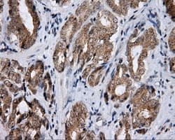 LIPG / Endothelial Lipase Antibody (clone OTI2D5)