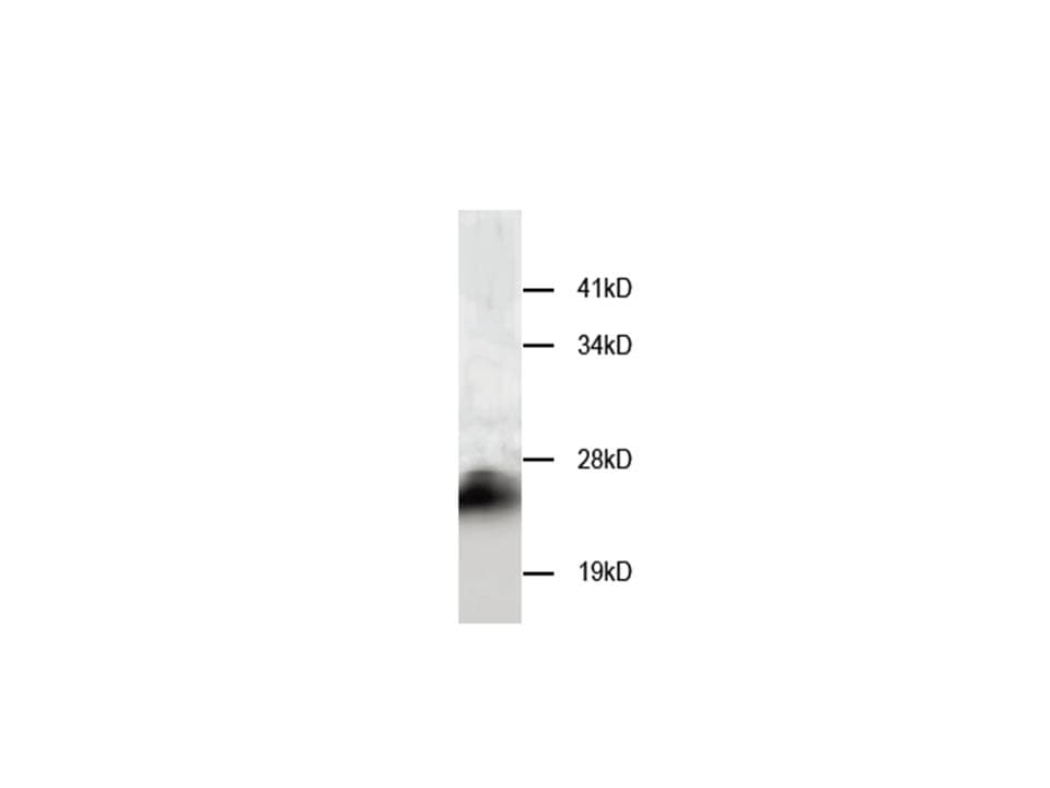 Monoclonal Mouse anti-Human CSTB / Cystatin B / Stefin B Antibody (WB)