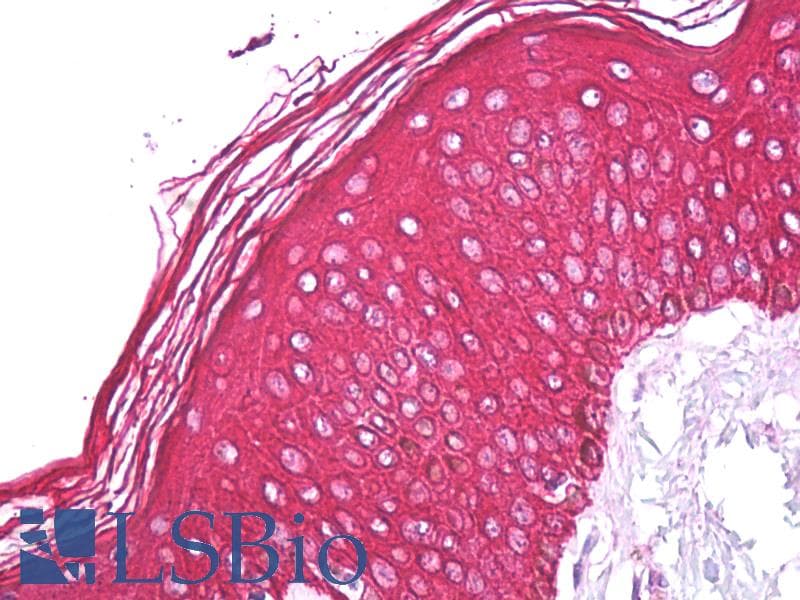 IHC-plus™ KRT1 / CK1 / Cytokeratin 1 Antibody (Internal)