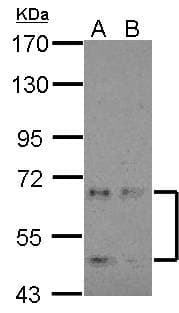 CDKL3 Antibody