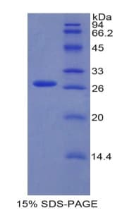 Mouse CBFA1 / RUNX2 Protein (Recombinant His, N-terminus)