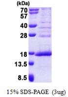 Human HCA557B / METTL21A Protein (Recombinant His)