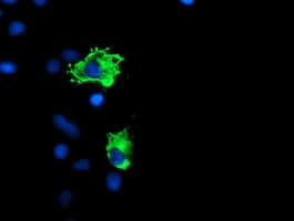 PPP1R15A / GADD34 Antibody (clone OTI3D12)