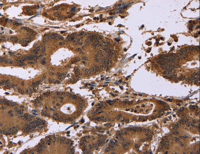 EDN2 / Endothelin 2 Antibody