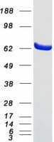 Human COT / CROT Protein (Recombinant Myc-DDK (Flag))