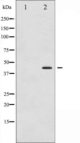 MAP2K1 / MKK1 / MEK1 Antibody (phospho-Ser221)