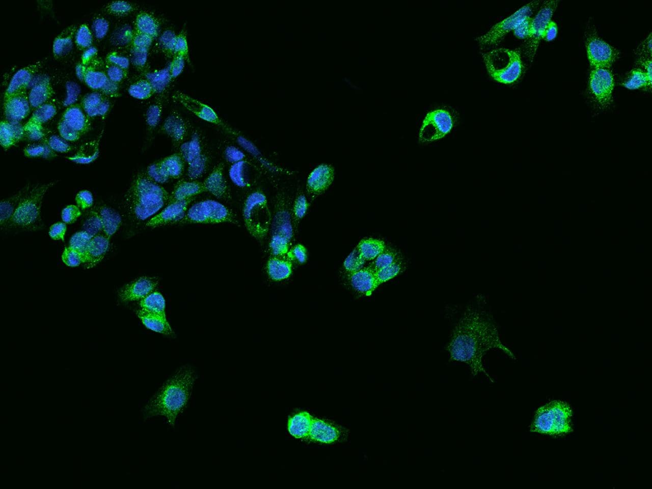 SLC39A7 / ZIP7 Antibody