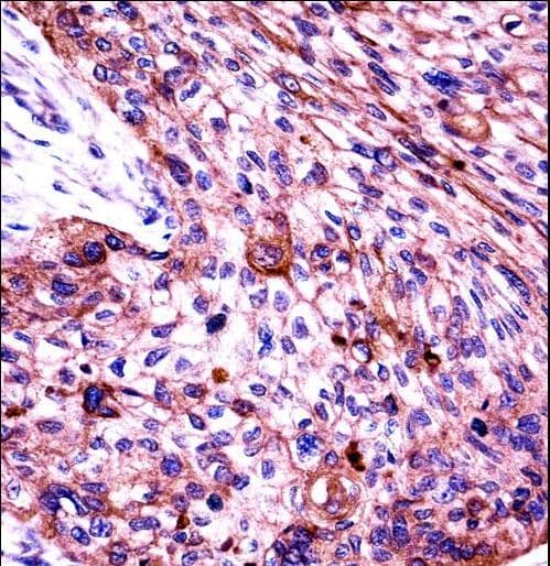 Polyclonal Rabbit anti-Human KRT6C / CK6C / Cytokeratin 6C Antibody (aa135-164, IHC, WB)