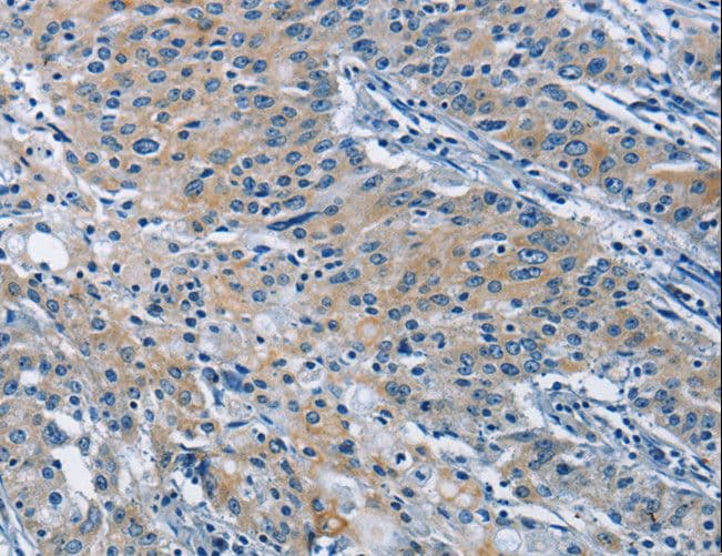 ALK-6 / BMPR1B Antibody