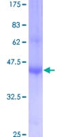 Human CD225 / IFITM1 Protein (Recombinant GST)