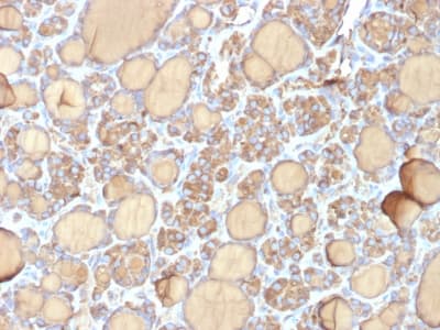 TG / Thyroglobulin Antibody (clone r6E1)