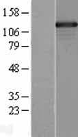 SMARCAD1 Protein (Over-Expression Lysate Myc-DDK (Flag))