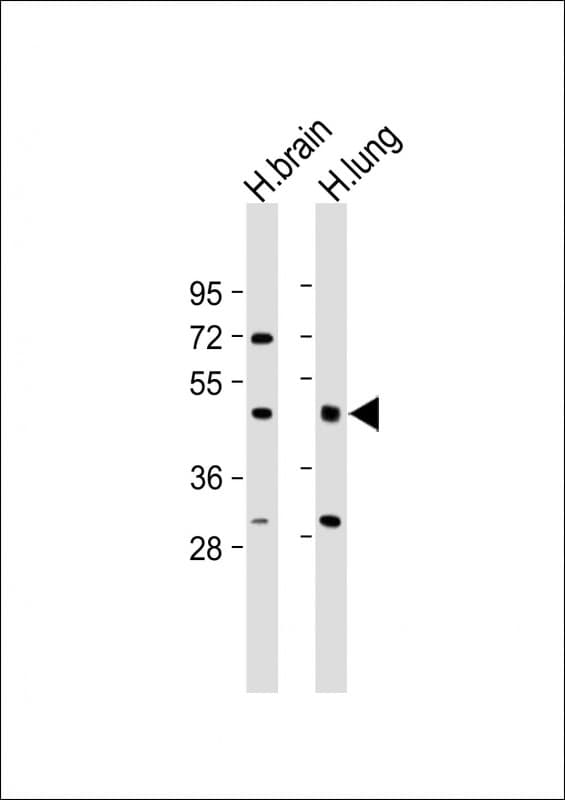 IFT57 / HIPPI Antibody (Internal)