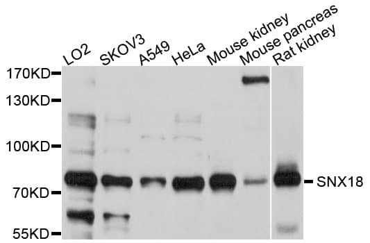 Polyclonal Rabbit anti-Human SNX18 Antibody (WB)