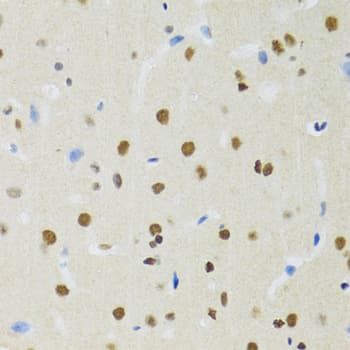 MTA3 Antibody