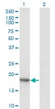 Monoclonal Mouse anti-Human KISS1 / Kisspeptin / Metastin Antibody (clone 1F7, WB)