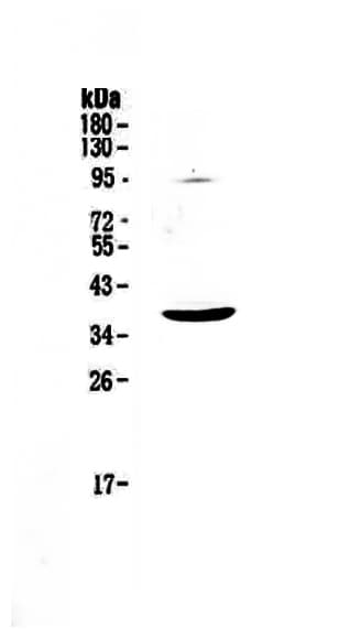 Polyclonal Rabbit anti-Human KITLG / SCF Antibody (IHC, WB)