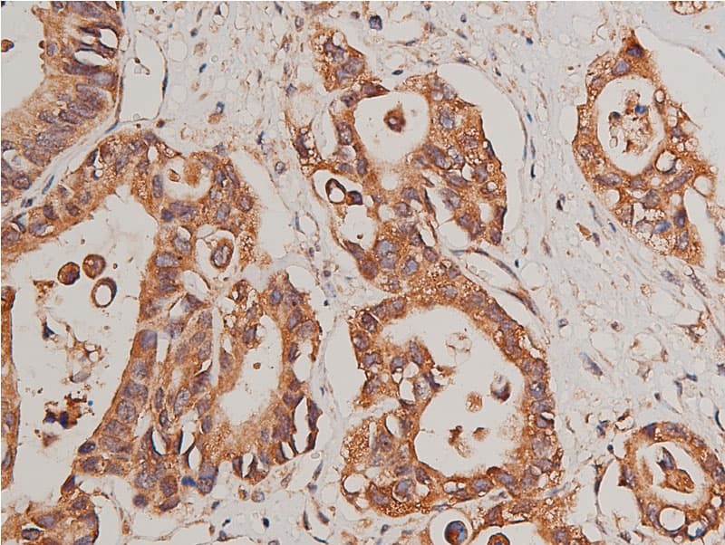 Polyclonal Rabbit anti-Human CYP17 / CYP17A1 Antibody (IHC, IF, WB)
