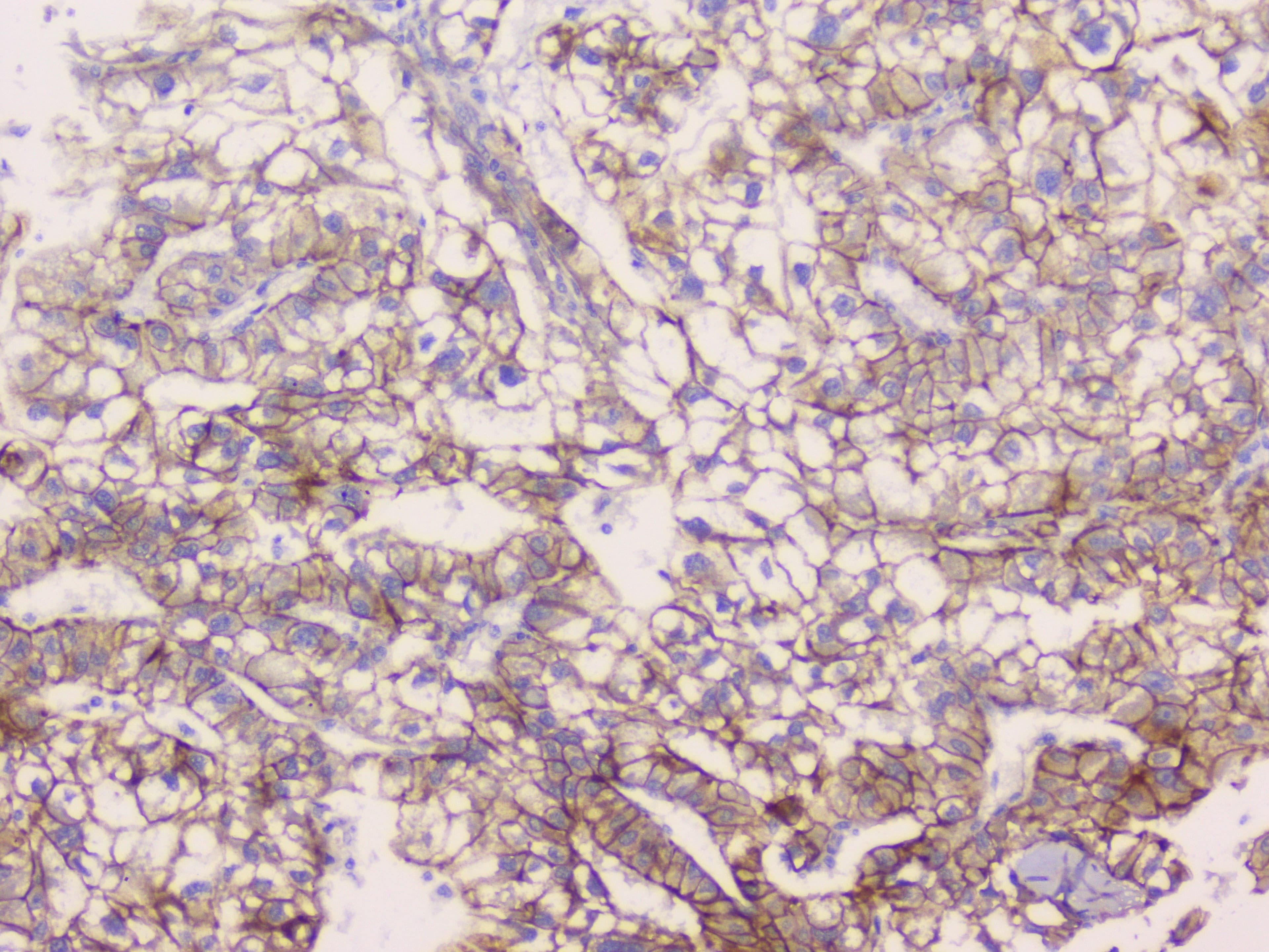 CTNNB1 / Beta Catenin Antibody