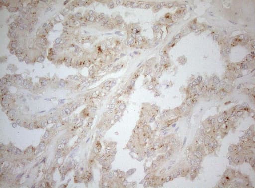 Monoclonal Mouse anti-Human CPM / Carboxypeptidase M Antibody (clone OTI2D11, aa124-423, IHC, WB)