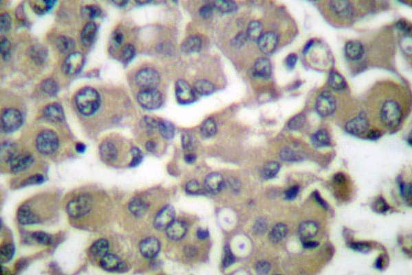 IVL / Involucrin Antibody (Pro568)