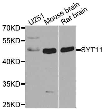 Polyclonal Rabbit anti-Human SYT11 Antibody (IHC, WB)