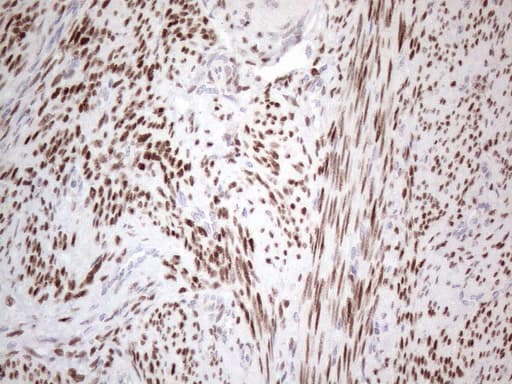 ER Alpha / Estrogen Receptor Antibody (aa1-310, clone OTI5E11)