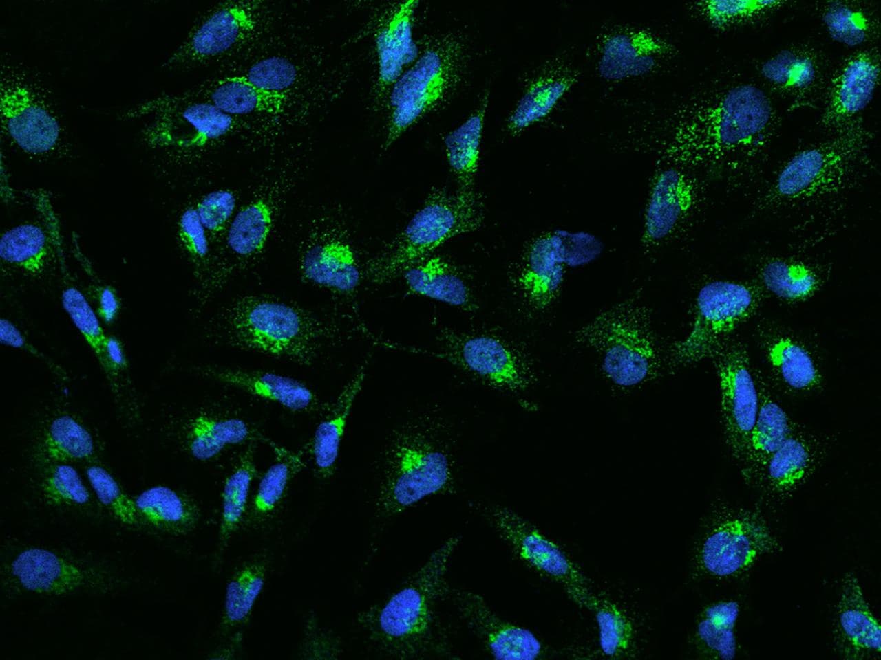 EPS8 Antibody
