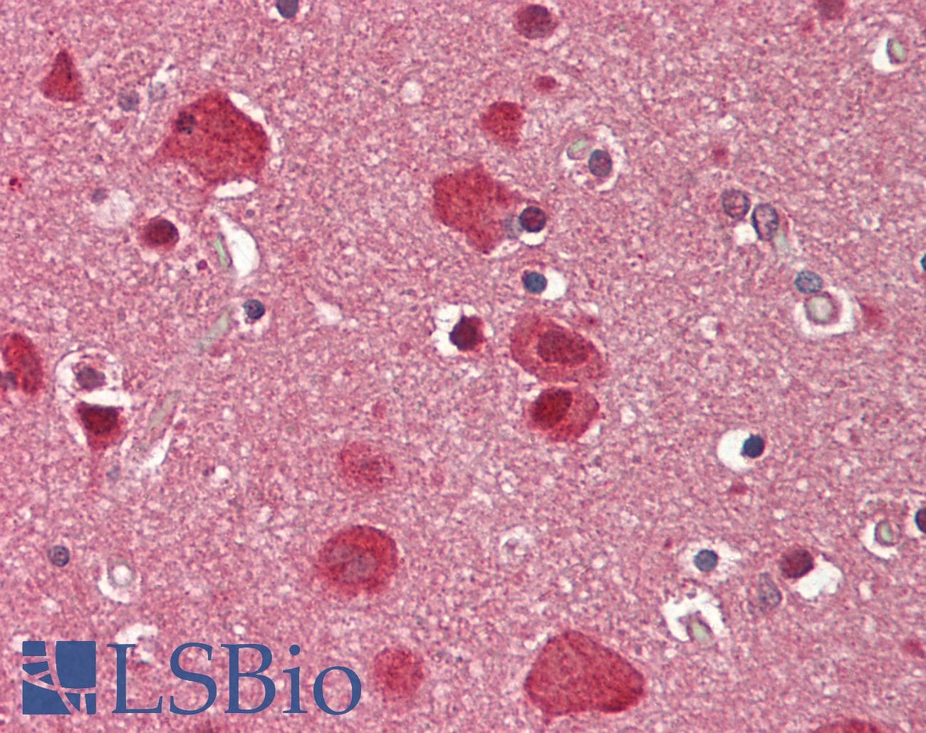 BAF60C / SMARCD3 Antibody (aa265-314)
