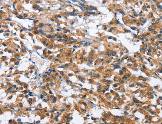 BPI Antibody