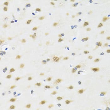 MTAP Antibody
