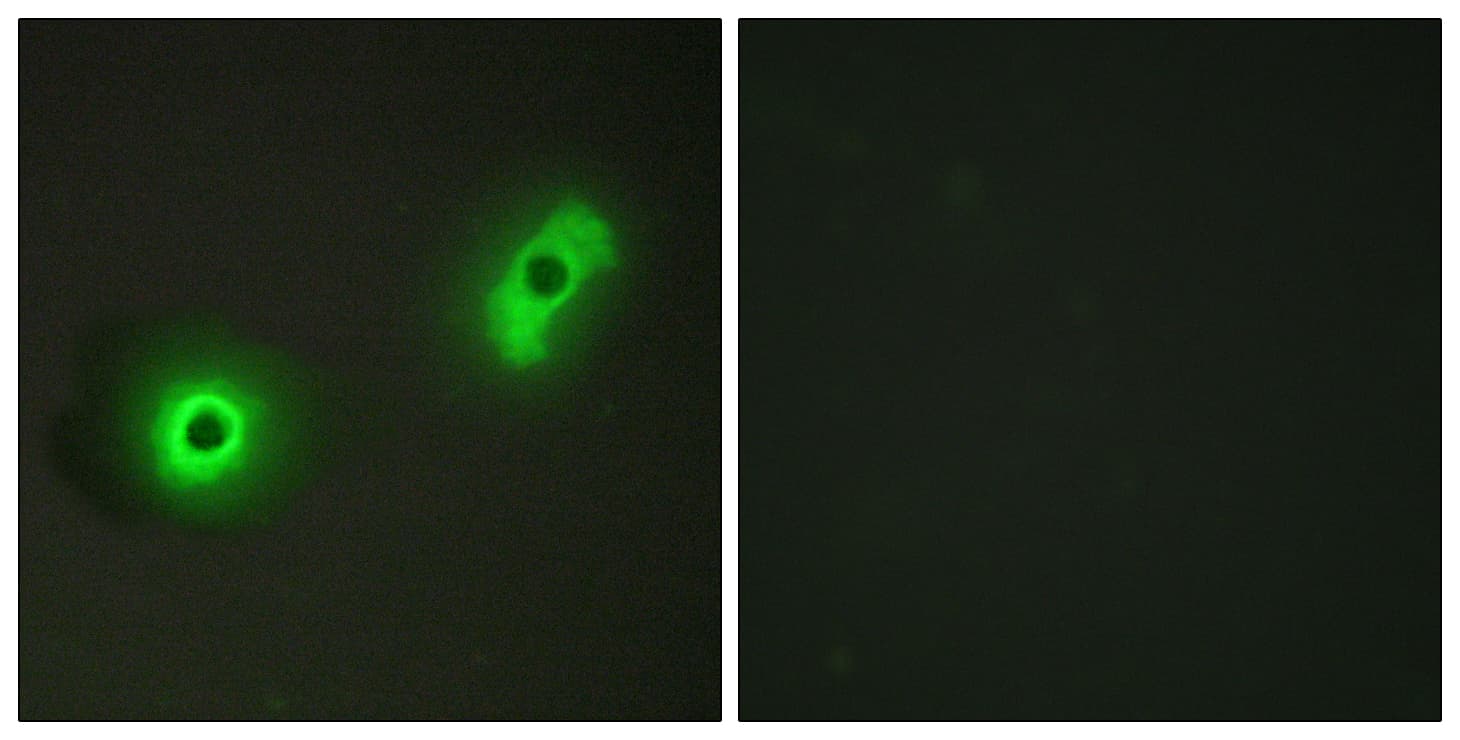 CABLES2 Antibody (aa91-140)
