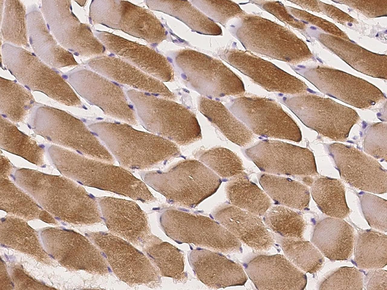 KLHL25 Antibody