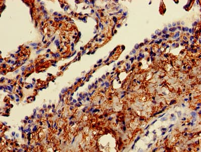 Polyclonal Rabbit anti-Human CAPZA2 / CAPZ Alpha 2 Antibody (aa2-286)